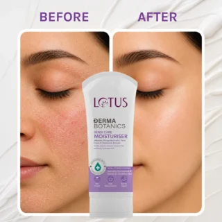 Lotus herbals Lotus Derma Botanics Sensi Care Moisturiser Hydration | Skin's natural barrier | Skin feeling soft - 75gm - 2